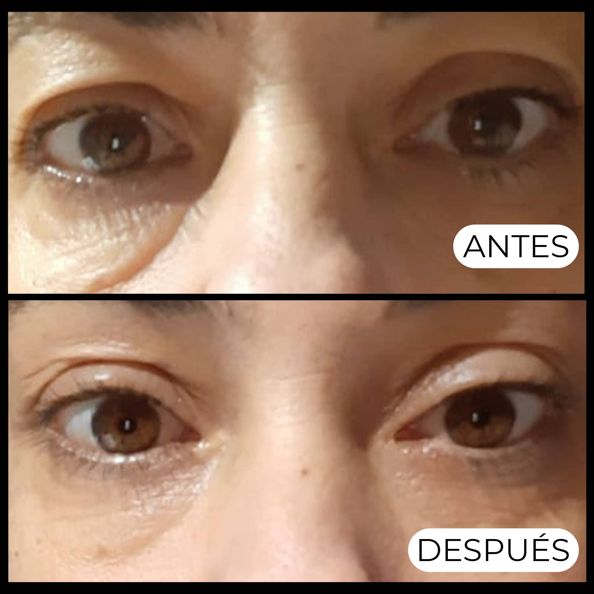 Contorno de Ojos Aguacate y Cafeína Formato Viaje 10ml | Alma Secret